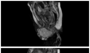 출산 순간 고스란히 기록한 MRI 영상 화제