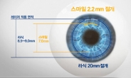 3D 스마일라식, “각막손상 줄여 회복속도 빨라졌다”