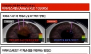 ‘아마리스 레드 올레이저 라섹’ 절삭량 최소화 연구 결과 대한안과학술대회 발표