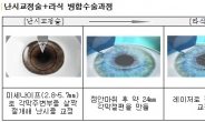 고도난시 먼저 해결하면 라식수술 ‘안전’ 높아진다