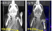 부작용 없는 전립선암 진단·치료제 나온다