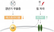 “침 치료로 중년여성 우울증 잡는다”