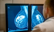 유방암 환자가 하는 '여성호르몬 수용체 검사', 영상 촬영으로 가능