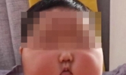 중국서 대박난 크림 발랐더니 아기 얼굴 '퉁퉁’…