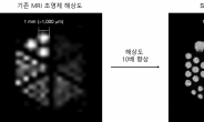 전세계 사망원인 1위 ‘뇌심혈관질환’ 진단정확도↑… 고성능 MRI 조영제 개발