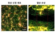 자생한방병원 척추관절연구소, 봉침 속 ‘아파민’ 성분 신경세포 재생 효과 입증