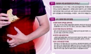 늘어나는 ‘난치성 크론병’…왜 MZ세대 환자가 많을까?