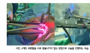 갑상선 로봇수술 후이개접근법의 학습곡선 분석