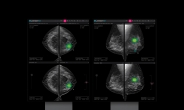 루닛, 3D 유방암 검진 ‘루닛 인사이트 DBT’ 美 FDA 승인 획득