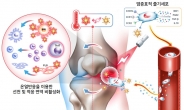 온열 반응 줄기세포 이용 중증 관절염 치료…세계 최초 구현