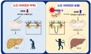 술도 안 마시는데 나이 드니 ‘지방간’ 생겨…‘이것’ 섭취하면 억제!