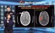 뇌경색 분석하는 AI 솔루션...SK C＆C, 식약처 허가 획득