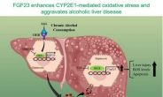 전남대 최흥식 교수연구팀, 알코올성 간 손상 핵심인자 규명