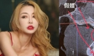 ‘성형수술 19번’ 30대 女모델, 공항검색대서 알람 울린 사연…해외서 무슨 일