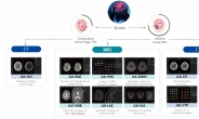 AI 의료 기업 ‘제이엘케이’, 외신서 美 진출 집중 조명