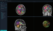 뷰노, AI 뇌 분석 의료기기 ‘뷰노메드 딥브레인’ 美 출시