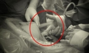 의사 손가락 잡은 아기 “덥석 악수” 감동