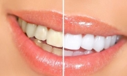 <생생건강 365> 치아 변색의 치료와 예방