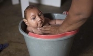 브라질, 소두증 아이낳고 버림받는 女 속출…비극