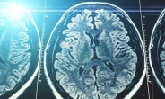 美 연구진 “여성의 뇌는 남성보다 젊어 보여”