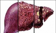 2020 노벨 생리·의학상, C형간염 바이러스 발견한  하비 알터, 마이클 호튼, 찰스 라이스 공동수상